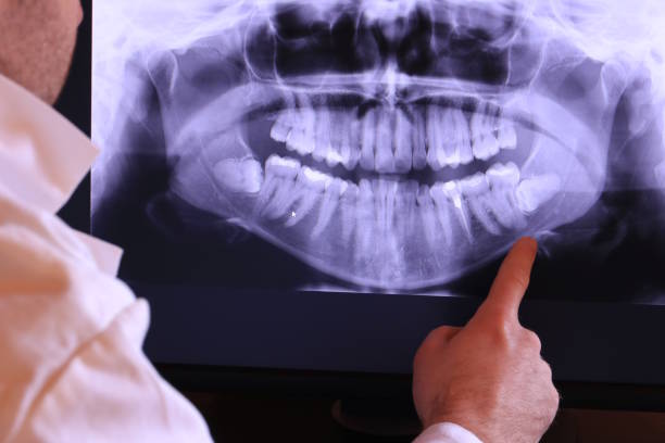 Best Emergency Treatment for Toothache in Saylorville, IA