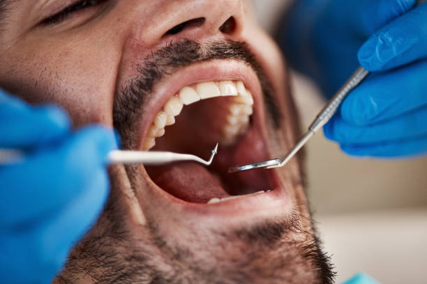 Best Emergency Dental Care for Trauma or Injury in Saylorville, IA
