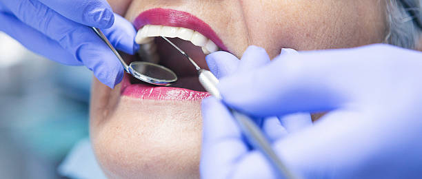 Best Emergency Wisdom Teeth Removal in Saylorville, IA